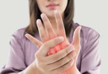 Artrita reumatoida afectarea mainii la femei